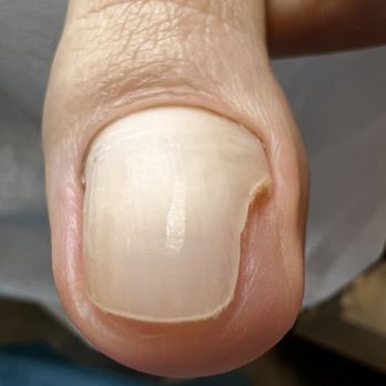 12 Nails Studio - Big toes nails - Nail Salons Near Me - Los Gatos, California 12 Nails Studio - Big toes nails - Nail Salons Near Me - Los Gatos, California