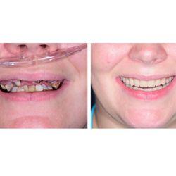 405 Implants & Dentures