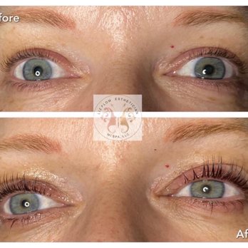 Mi Spa - Liz Flom - Skin Care Near Me - Merritt Island, Florida