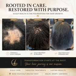 Lillian Te’ Laurie Hair Restoration
