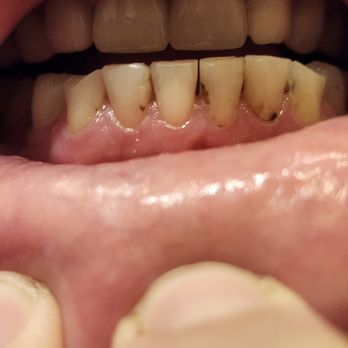 Westport Dental - Before - General Dentistry Near Me - Anaheim, California Westport Dental - Before - General Dentistry Near Me - Anaheim, California