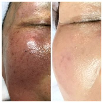 D&H Beauty - Skin Care Near Me D&H Beauty - Skin Care Near Me