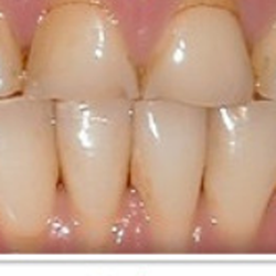 Raminder Singh, DDS - Elite Dental & Denture
