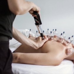 Cupping Therapy helps with circulation and promotes great healing.