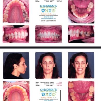 Surilo's Center for Pediatric Dentistry & Orthodontics - Orthodontists Near Me - La Mesa, California