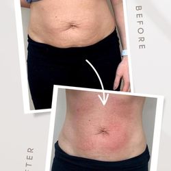 ReShaped Contouring Studio