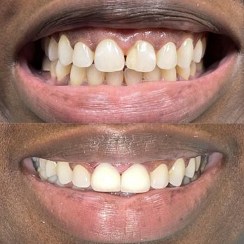 Gateway Dental Group - Oral Surgeons Near Me - Fairfield, California Gateway Dental Group - Oral Surgeons Near Me - Fairfield, California