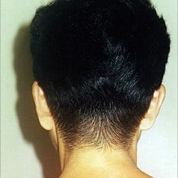 Charle-A Hair Studio - Integration unit. Ideal for woman w/ androgenetic alopecia