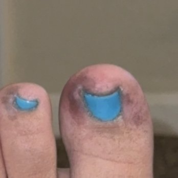 Nails By David Lee - Busied toes after pedicure - Nail Salons Near Me - Modesto, California