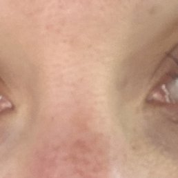 Lash lift