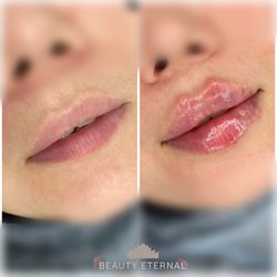Beauty Eternal