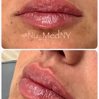 Nu Med - Medical Spas Near Me - Merrick, New York