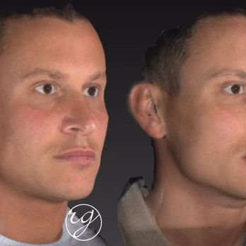 RG Aesthetic Plastic Surgery - #FacebyRG - Medical Spas Near Me - Franklin, Tennessee RG Aesthetic Plastic Surgery - #FacebyRG - Medical Spas Near Me - Franklin, Tennessee