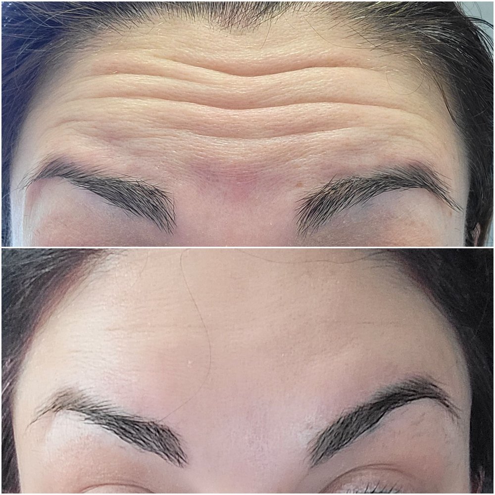CynSational Aesthetics - My jeuveau results! - Medical Spas Near Me - Elk Grove, California CynSational Aesthetics - My jeuveau results! - Medical Spas Near Me - Elk Grove, California