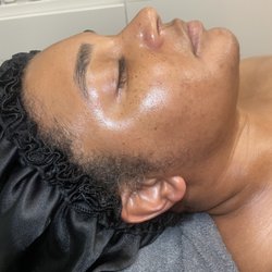 Freckles & Brows - Dramatic reduction in hyperpigmentation and acne because of the series of gentle, yet progressive PCA SKIN peels+.