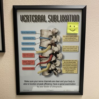 Mission Hills Chiropractic - Vertebral subluxation - Chiropractors Near Me - Lake Forest, California Mission Hills Chiropractic - Vertebral subluxation - Chiropractors Near Me - Lake Forest, California