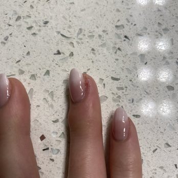 La Noir Nails and Lashes - Infected nail from deep cut of nail drill - Nail Salons Near Me - Cypress, California La Noir Nails and Lashes - Infected nail from deep cut of nail drill - Nail Salons Near Me - Cypress, California