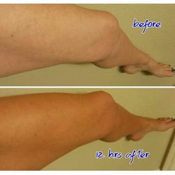 Generations Mobile Spray Tan & Teeth Whitening - Before and after