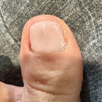ORGANIC NAILS- Spa & Lounge - After pedicure - terrible - Nail Salons Near Me - Brea, California ORGANIC NAILS- Spa & Lounge - After pedicure - terrible - Nail Salons Near Me - Brea, California