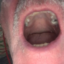 Bayview Dental - Great Dental work