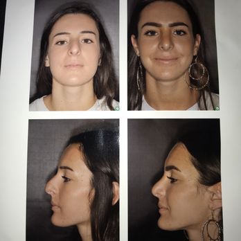 Michael V Elam, MD - Cosmetic Surgeons Near Me - Newport Beach, California Michael V Elam, MD - Cosmetic Surgeons Near Me - Newport Beach, California