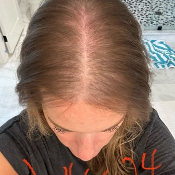 Parker Trichology Centre - Hair Loss Centers Near Me - Carrollton, Texas Parker Trichology Centre - Hair Loss Centers Near Me - Carrollton, Texas