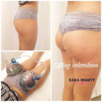 Kara Beauty - Hair Removal Near Me - Lyon, 69