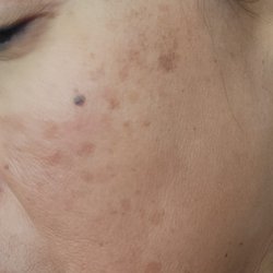 Advanced Aesthetics - Before Dori worked her magic!  Oct 2021.