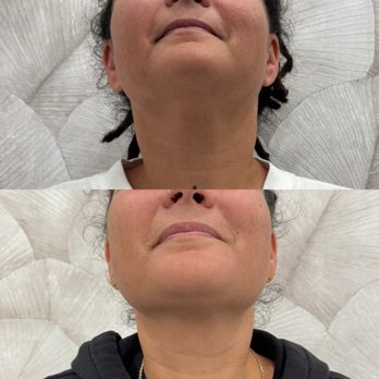 Collagen Project - Medical Spas Near Me - Miami Beach, Florida