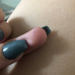 More acrylic under nails. More acrylic under nails.