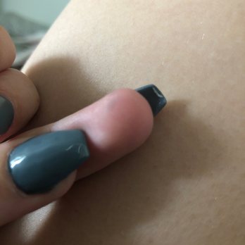 4 Season Nail Spa - More acrylic under nails. - Nail Salons Near Me - Clarksville, Tennessee 4 Season Nail Spa - More acrylic under nails. - Nail Salons Near Me - Clarksville, Tennessee