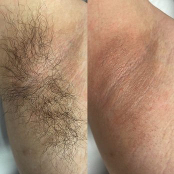 Bestetix - underarm wax
Book your service today!
@bestetix - Skin Care Near Me - San Antonio , Texas Bestetix - underarm wax
Book your service today!
@bestetix - Skin Care Near Me - San Antonio , Texas