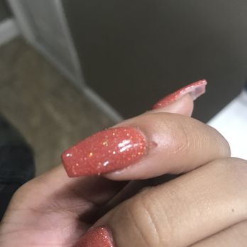 PG Nails & Spa - Better pic of the severity of how deep it is and has been since i left THROBBING IN PAIN thanks Kevin - Nail Salons Near Me - Hyattsville, Maryland PG Nails & Spa - Better pic of the severity of how deep it is and has been since i left THROBBING IN PAIN thanks Kevin - Nail Salons Near Me - Hyattsville, Maryland