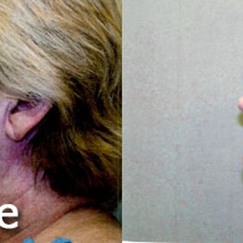 Image Cosmetic Surgery Center - Facelift - Cosmetic Surgeons Near Me - Acworth, Georgia Image Cosmetic Surgery Center - Facelift - Cosmetic Surgeons Near Me - Acworth, Georgia
