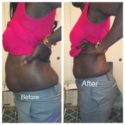 Slender Wave Cavi Lipo Ultrasound - Before and after one treatment