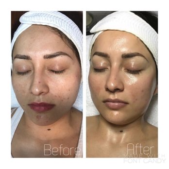 Rose Ela Studio - Skin Care Near Me - Nanuet, New York
