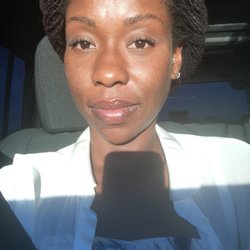 Skin Essence -Long Beach - No need for a ton of concealer thanks to your treatment. I can still see a few problem areas but, good.