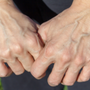 Ponte Vedra Vein Institute