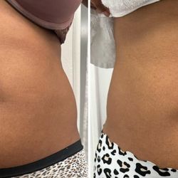 Best & Beyond Spa - Multishape-Body Sculpting. Before and after one session
