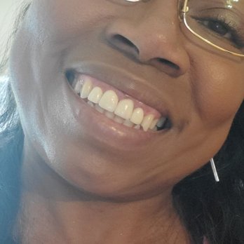 Flamingo Smiles Dentistry - My happy AFTER smile - General Dentistry Near Me - Las Vegas, Nevada Flamingo Smiles Dentistry - My happy AFTER smile - General Dentistry Near Me - Las Vegas, Nevada