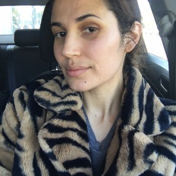 Ava MD - Me today and everyday and all I do is wash my face and see Mojan every two months. I will forever go to Mojan - Dermatologists Near Me - Santa Monica, California