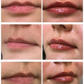Marcel Aesthetics - Medical Spas Near Me - Santa Clarita, California Marcel Aesthetics - Medical Spas Near Me - Santa Clarita, California
