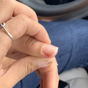 Solar Nails - Cut on finger - Nail Salons Near Me - Brownsville, Texas