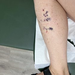 Kaloko Urgent Care - Wana sting