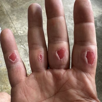 Jungle Island - What happen to me by not being advise to bring gloves - Amusement Parks Near Me - Miami, Florida Jungle Island - What happen to me by not being advise to bring gloves - Amusement Parks Near Me - Miami, Florida