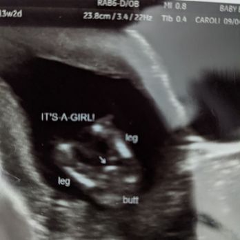 Baby Bump Studios  - Diagnostic Imaging Near Me - Ontario, California