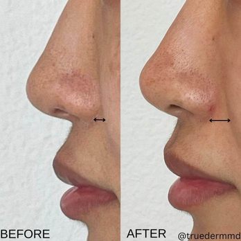 True Dermatology - Acne Treatment Near Me - Monterey Park, California True Dermatology - Acne Treatment Near Me - Monterey Park, California