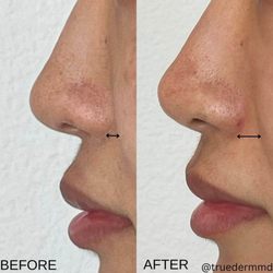 True Dermatology