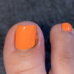 ZA Nails Spa - Infection due to a deep cut.