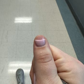 Gloss Nail Bar - Broken at day 6 - Nail Salons Near Me - Houston, Texas Gloss Nail Bar - Broken at day 6 - Nail Salons Near Me - Houston, Texas